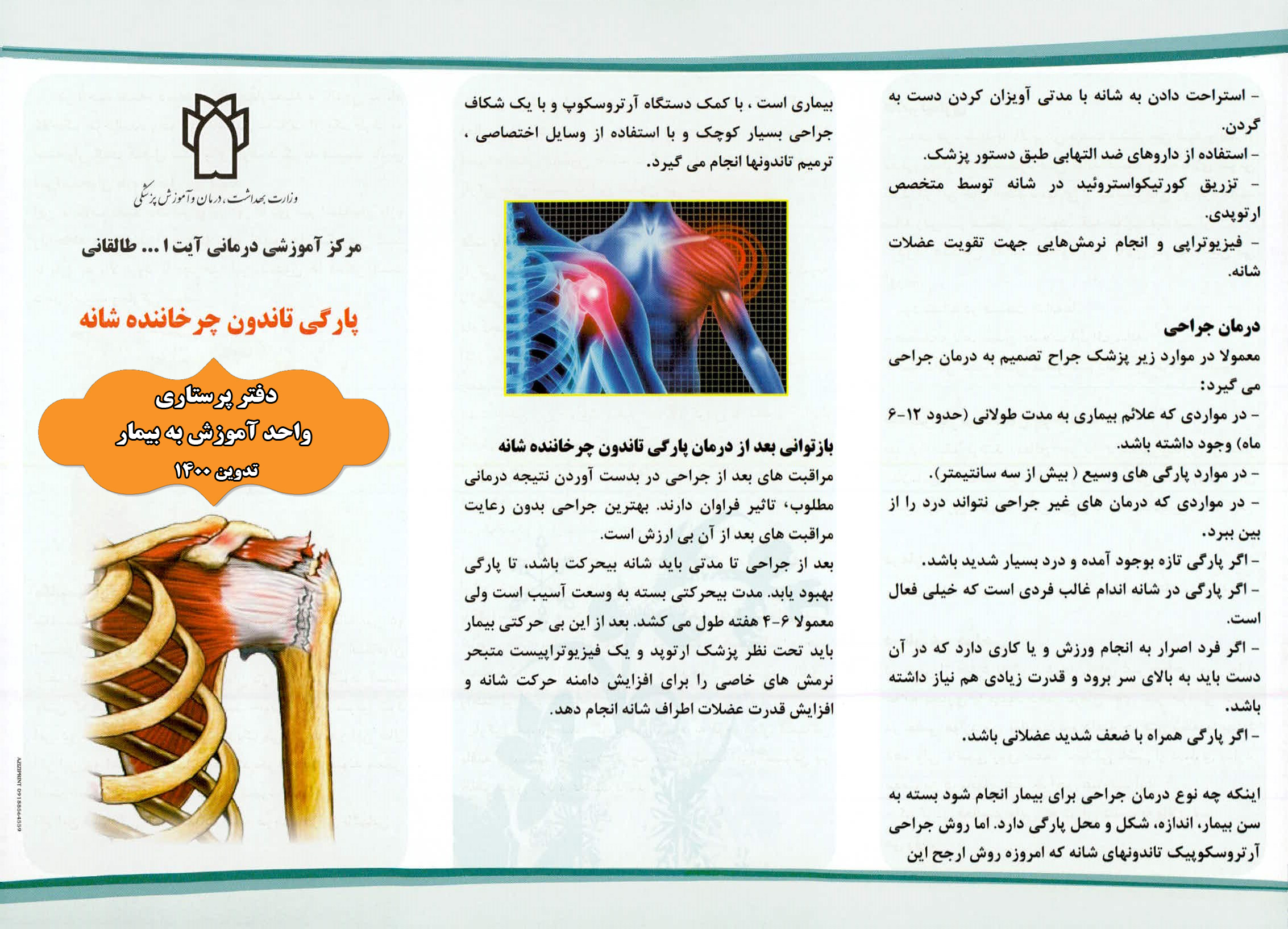 پارگی تاندون شانه