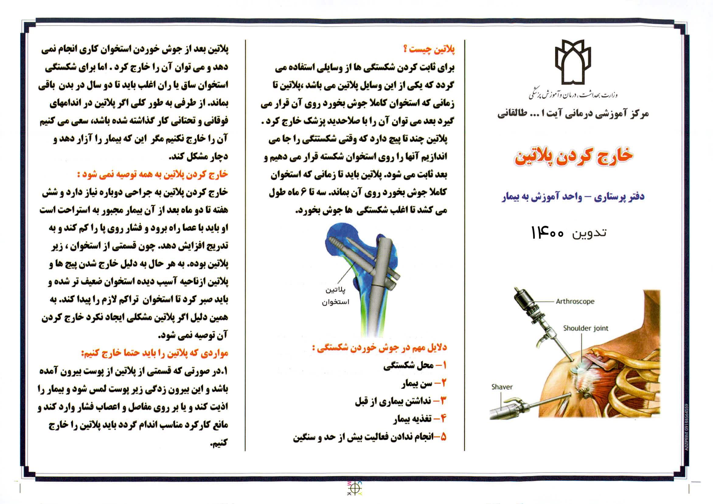 خارج کردن پلاتین