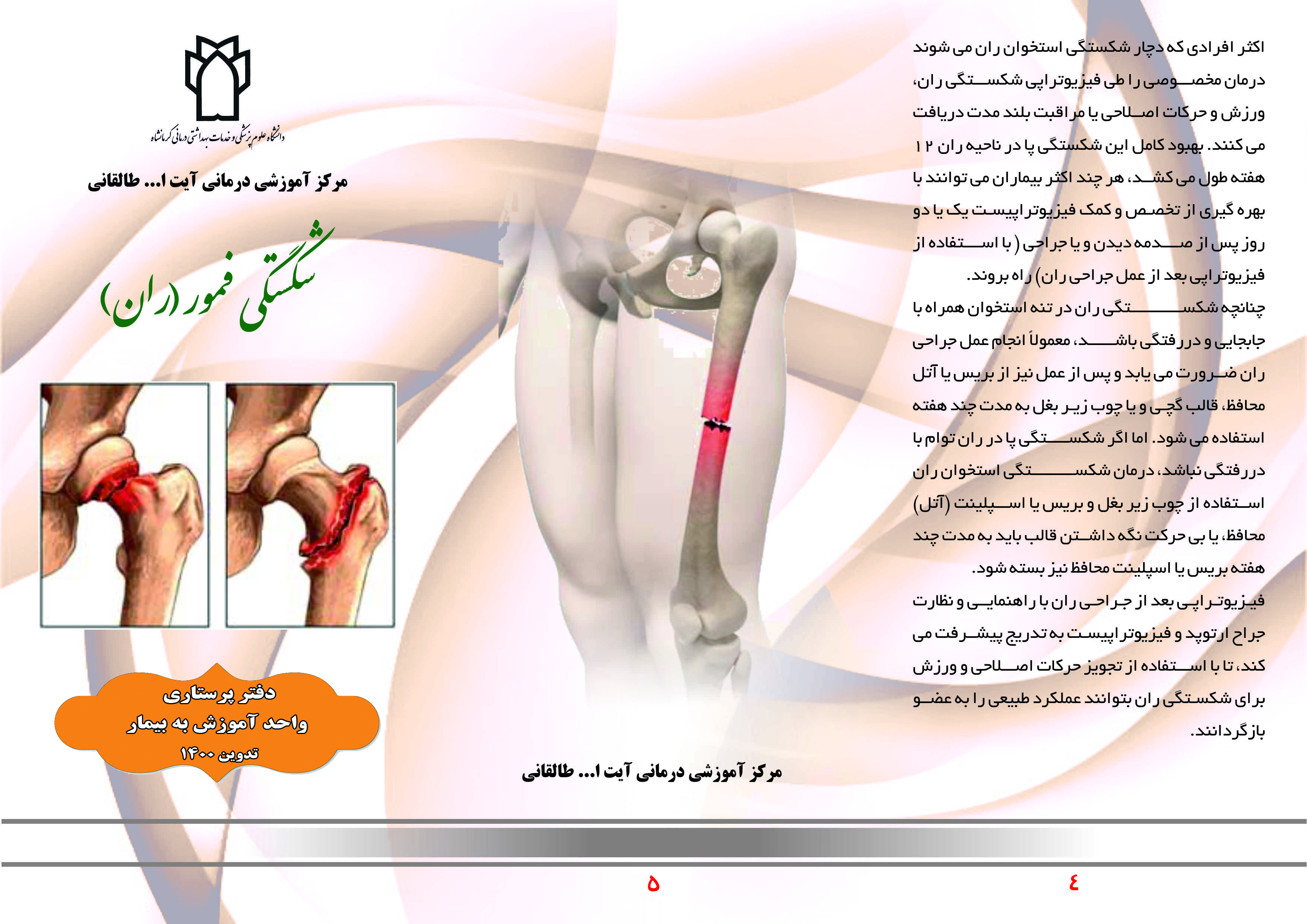 شکستگی ران و لگن