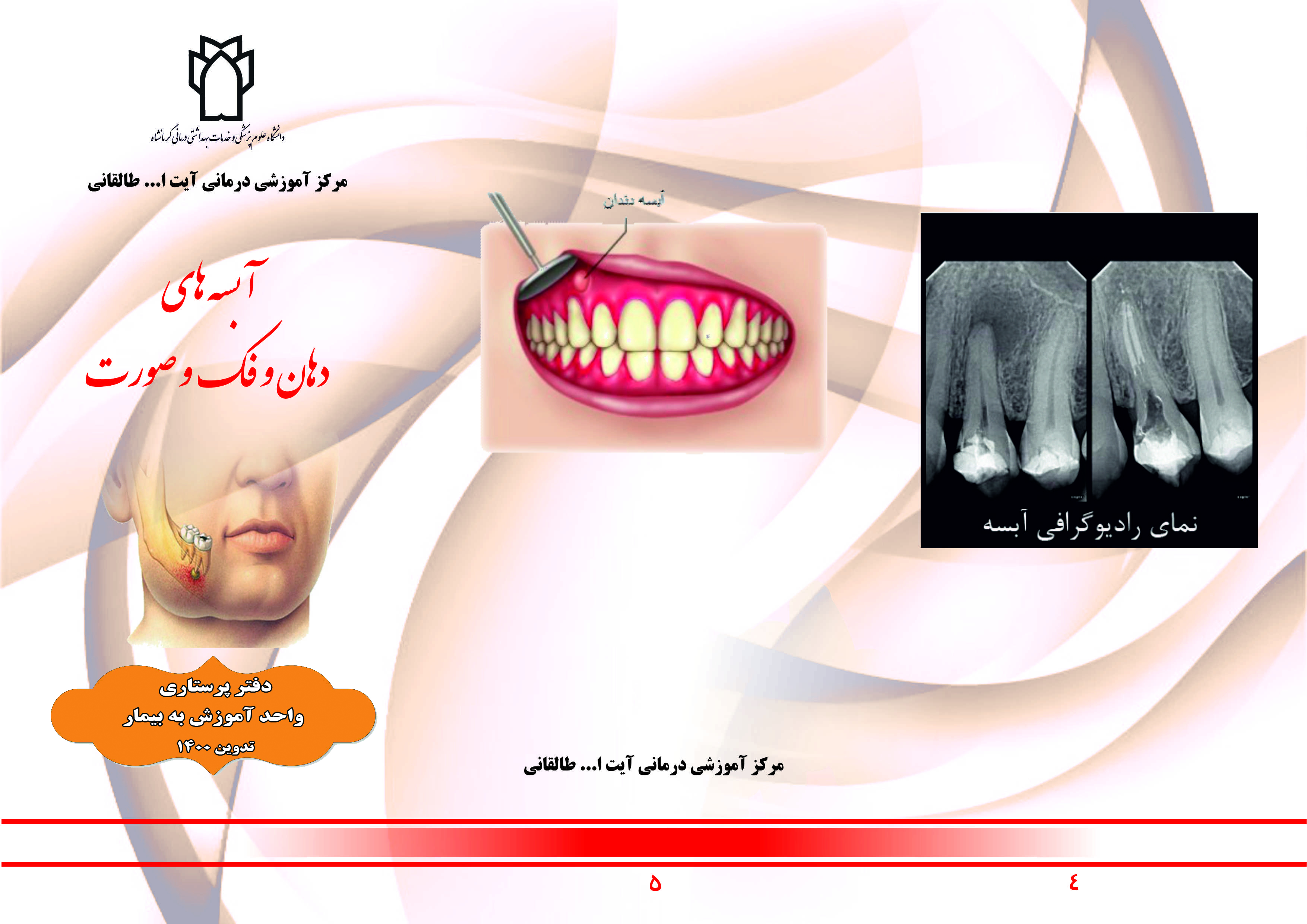 آبسه دهان و فک