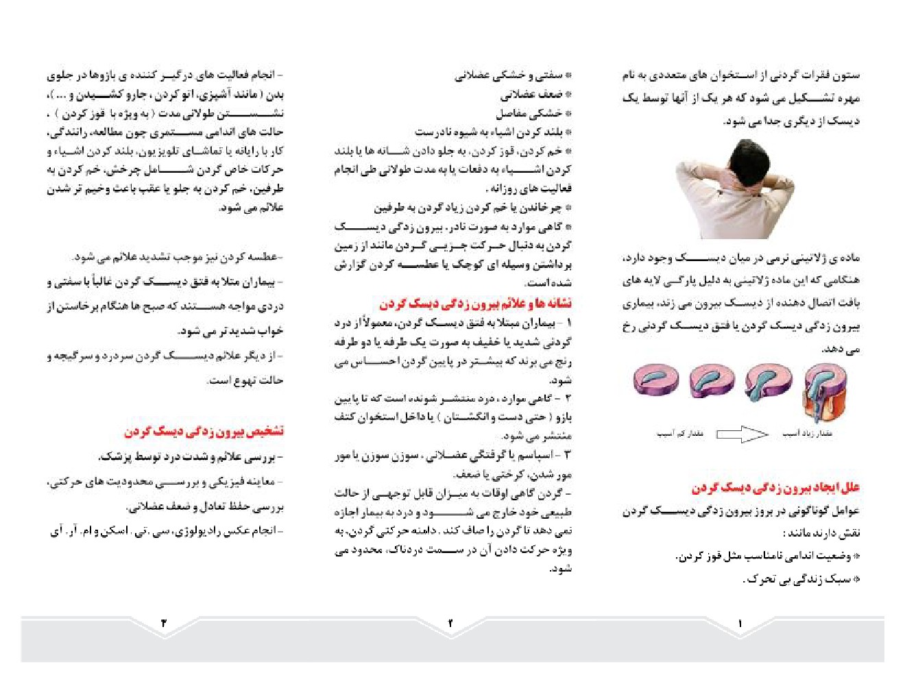 بیرون زدگی دیسک گردن