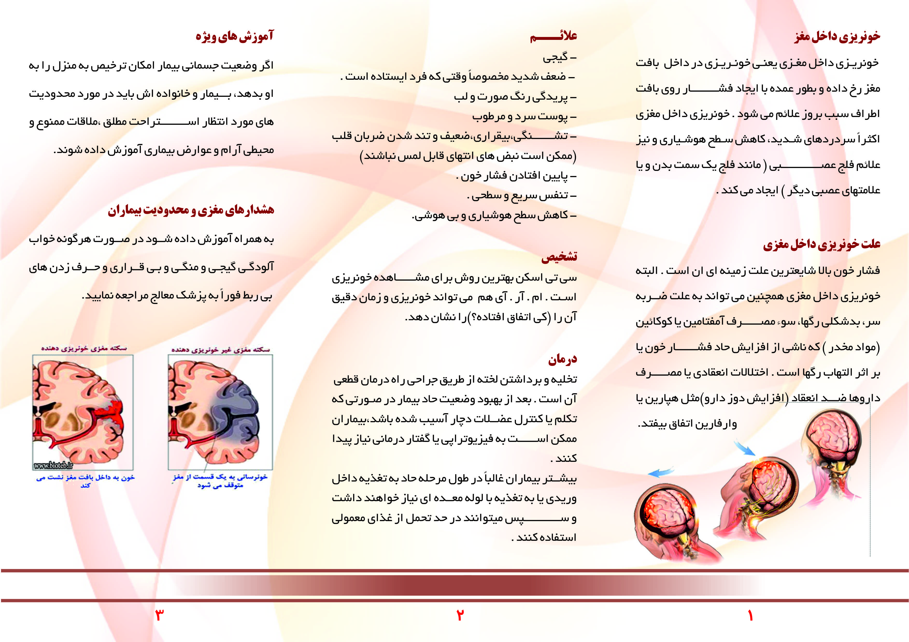 خونریزی مغزی