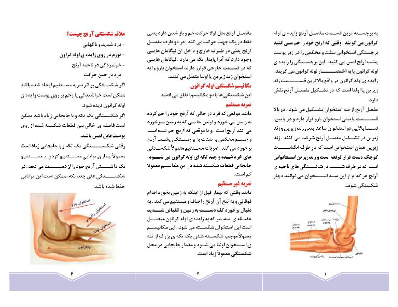 شکستگی بازو1